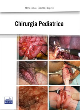 Chirurgia Pediatrica